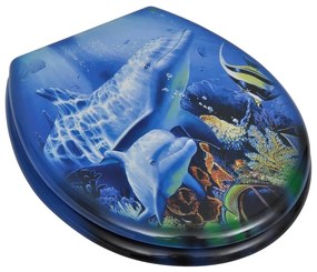 Assentos de sanita com tampas 2 pcs MDF golfinho